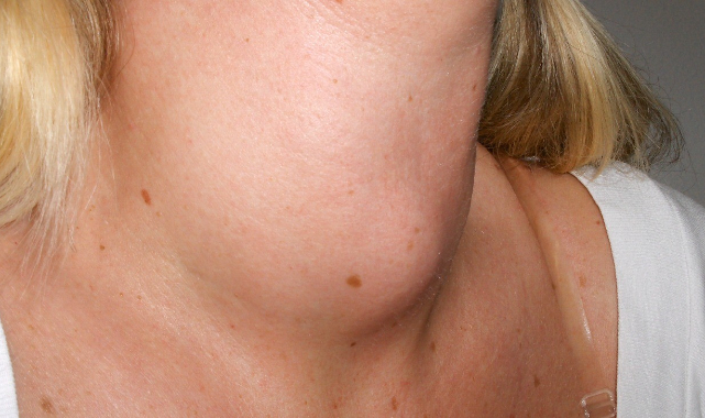 Genel cerrahi uzmanı Op. Dr. Murat Uzuner: 