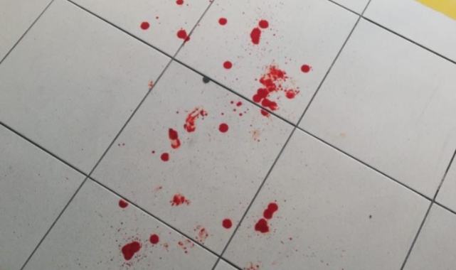 Bursa'da İmam Hatip Lisesi'nde Gasp ve Şiddet: Müdür Yardımcısının Burnu Kırıldı