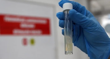 DSÖ: Tüberküloz, 2024’te 1,23 milyon kişinin ölümüne yol açtı