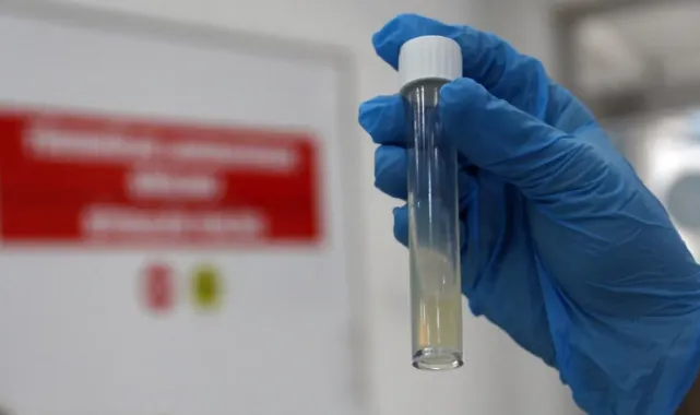 DSÖ: Tüberküloz, 2024’te 1,23 milyon kişinin ölümüne yol açtı