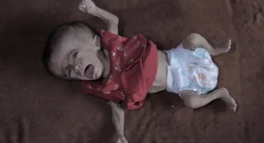 Gazze’de 5 Aylık Remzi Bahara Açlıkla Yaşam Mücadelesi Veriyor