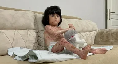 4 Yaşındaki İbrahim'in 'kelebek hastalığı' hayatını zorlaştırıyor