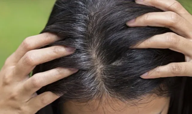  Beyaz saçları kapatan ev yapımı doğal boya tarifi