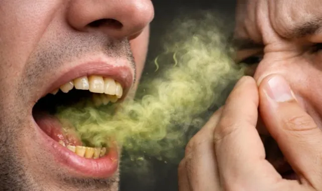 Ramazan’da Sürekli Kötü Nefes Neden Olur? Uzmanlar Uyarıyor