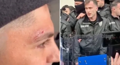 Bursa'da Başkan Vekili Seçiminde Polisler Yaralandı