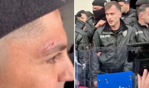 Bursa'da Başkan Vekili Seçiminde Polisler Yaralandı