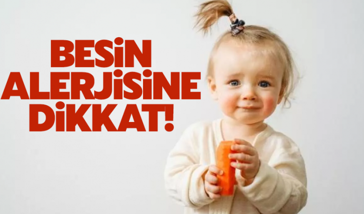 Besin alerjisine dikkat!