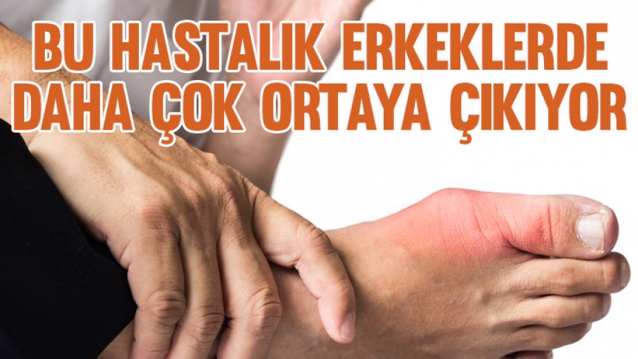 Bu Hastalık Erkeklerde Daha Çok Ortaya Çıkıyor