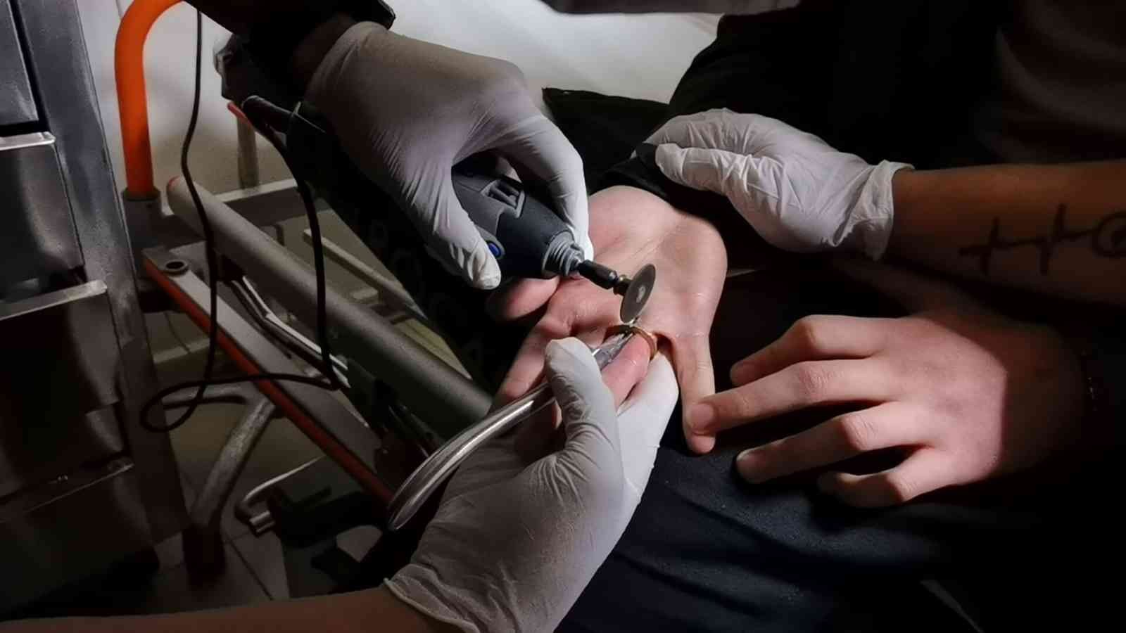Bursa'da İlginç Olay: Parmağına 1 tl Sıkıştı