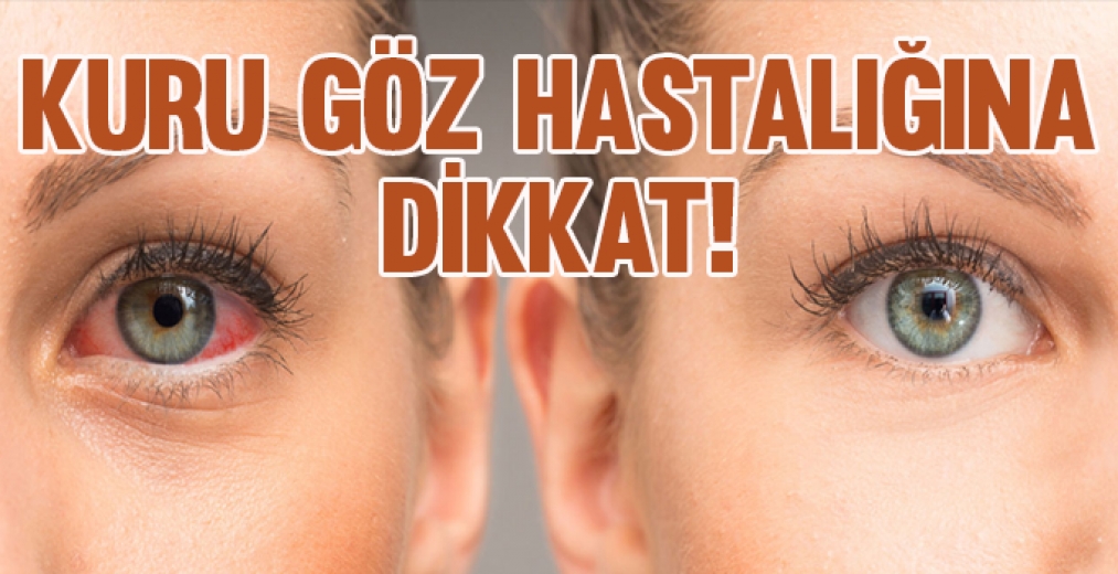 Kuru Göz Hastalığına Dikkat!