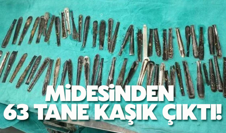 Midesinden 63 tane kaşık çıktı!