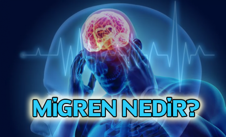 Migren nedir?