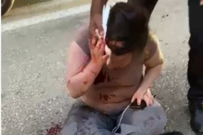 Otomobilin çarptığı kadın yolun kenarına savruldu!