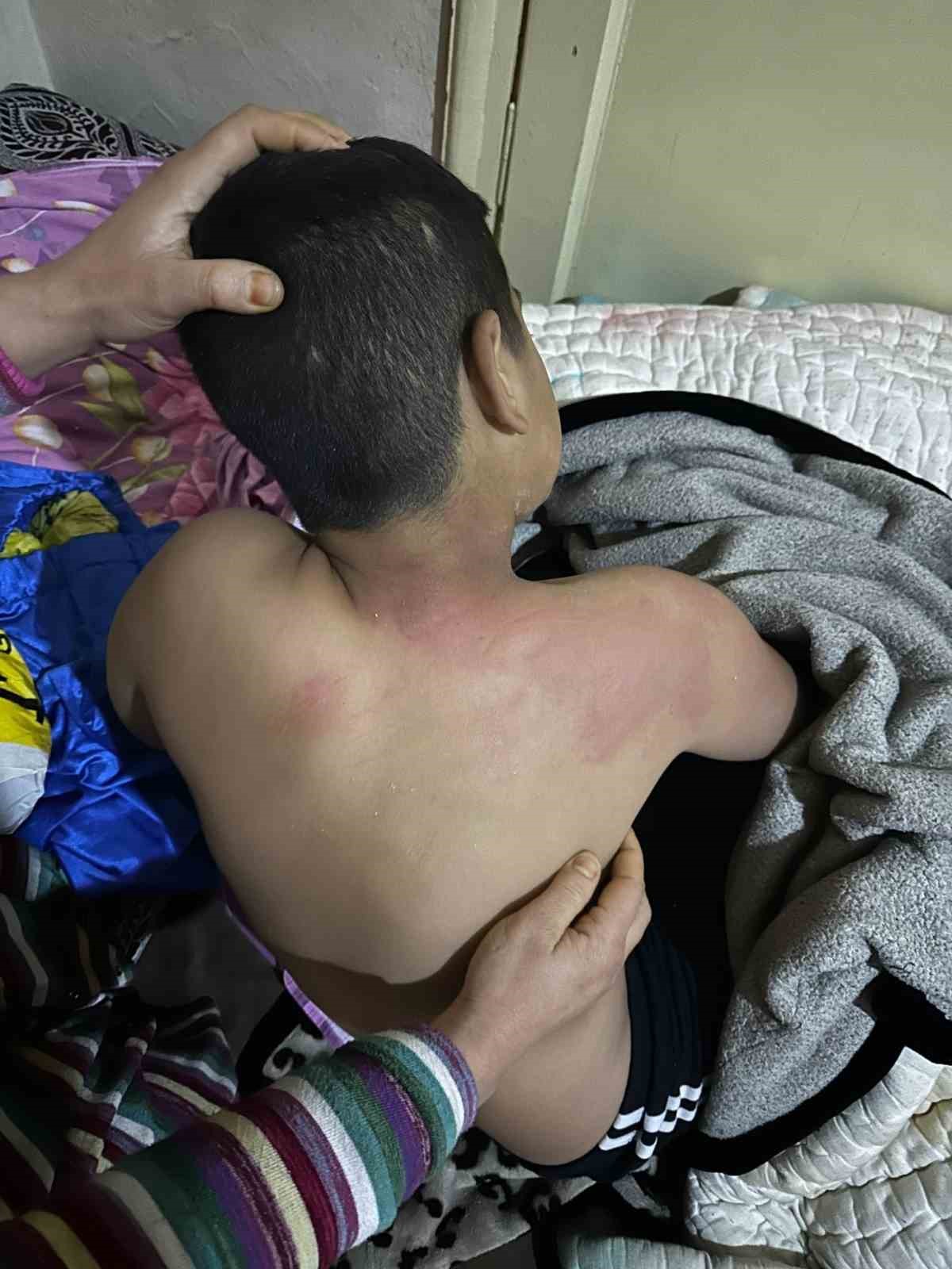 Seçim Bürosuna Gelen Çocuğu Kaynar Çayla Yaktı, Tutuklandı