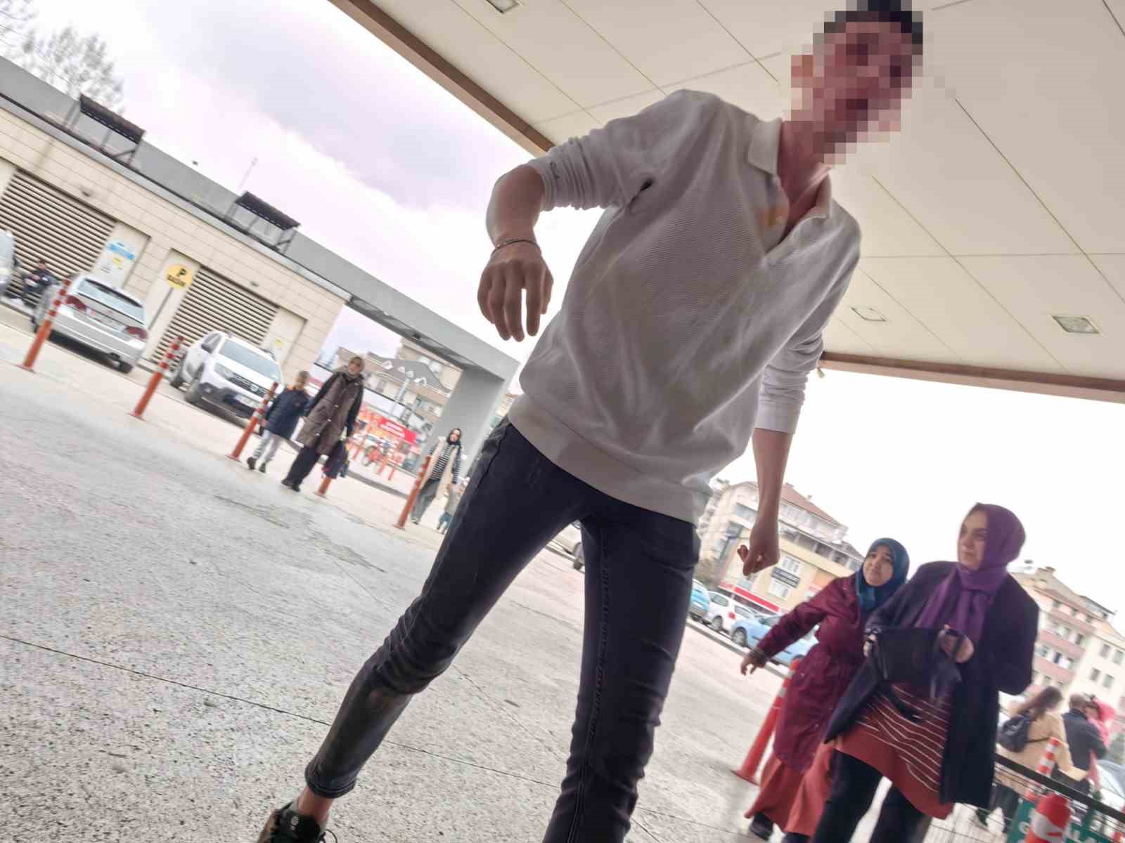 Sevgilisinin Abisi Önce Darp Etti, Sonra Biber Gazı Sıktı
