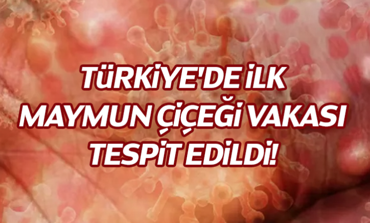 Türkiye'de ilk Maymun Çiçeği vakası tespit edildi!