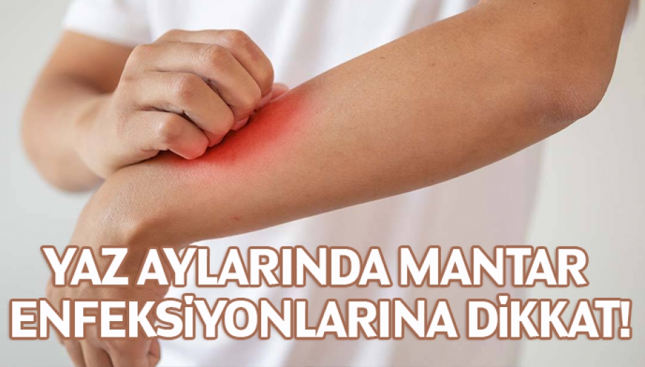 Yaz Aylarında Mantar Enfeksiyonlarına Dikkat!