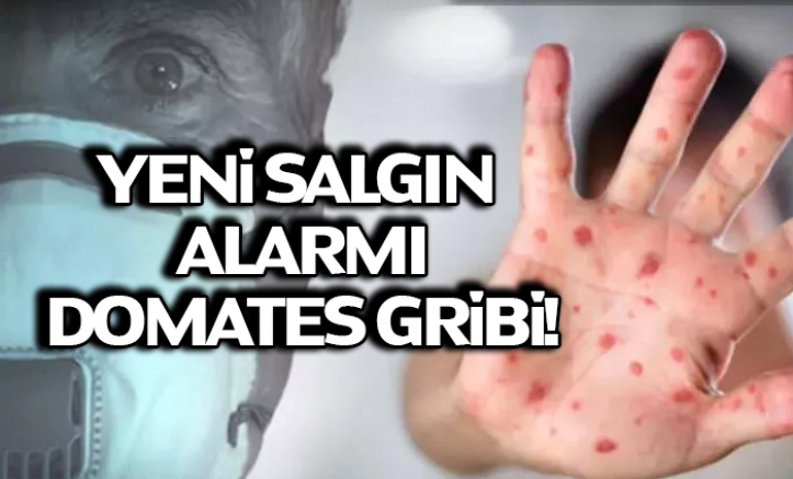 Yeni salgın alarmı: Domates gribi! Bu 5 belirtiye dikkat